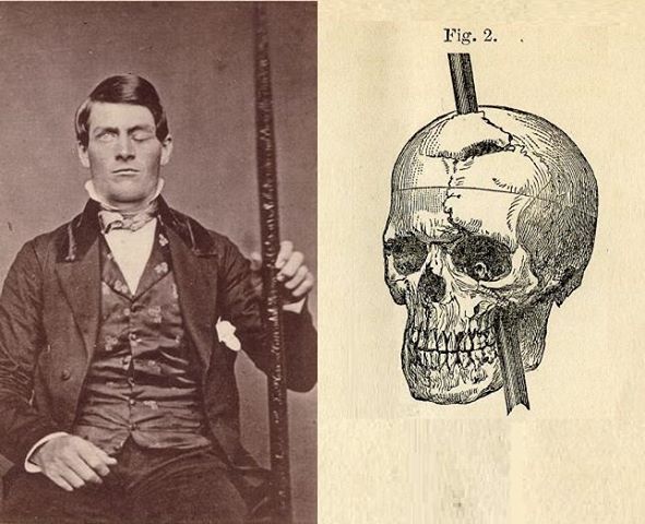 Image result for The Curious Case of Phineas Gage