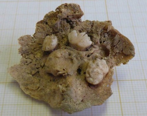 cultofweird:
“ Archaeologists unearthed a teratoma (tumor with teeth) from a burial dating to between the 16th and 18th centuries in Lisbon.
Read the article here.
”