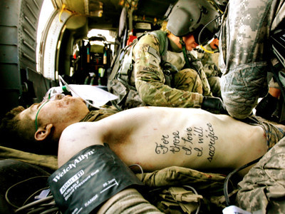 This image on Time magazine’s website shows infantryman Kyle Hockenberry in a helicopter in Afghanistan receiving treatment after surviving a road-side bomb blast in which he lost both his legs and his left arm. On the right side of his ribcage is a...