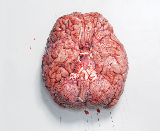 shawnali:
“ The first time I held a human brain in Anatomy Lab I was completely speechless. I looked at my classmates expecting a similar reaction and they looked back at me confused like…”dude let’s start identifying the structures.” I had to take a...