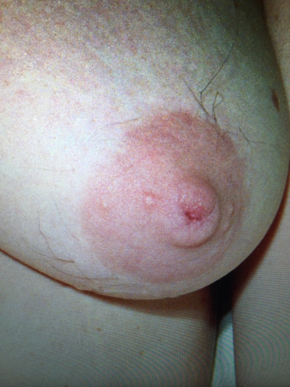 Hairy Nipples Women 26