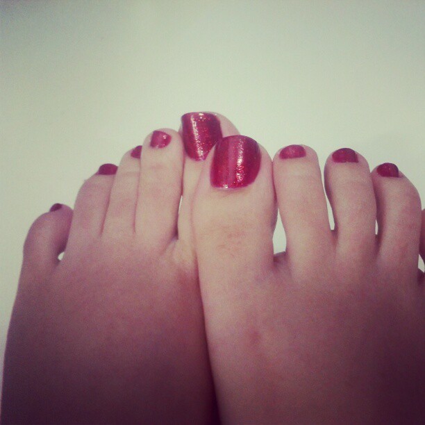 Foot Is Bright Red 34