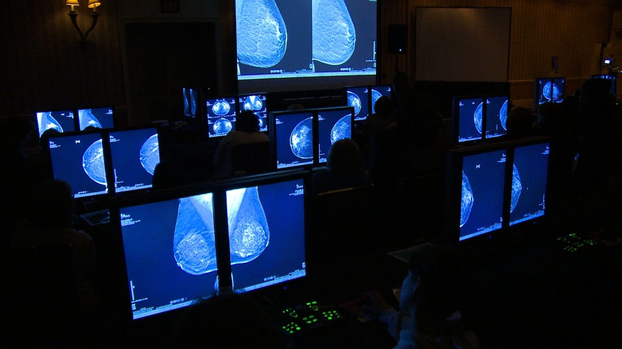 During the filming of ‘Detected,’ radiologists study 3D mammography to better understand dense breast tissue.