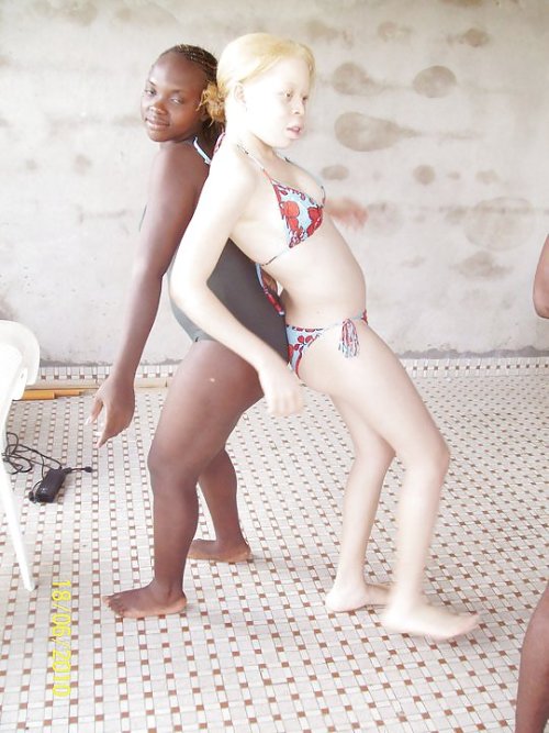 Nude Albino Teens 72