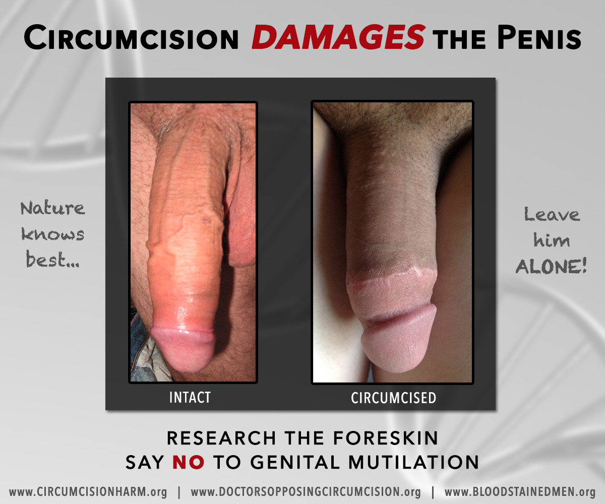 Large Circumcised Penis 43