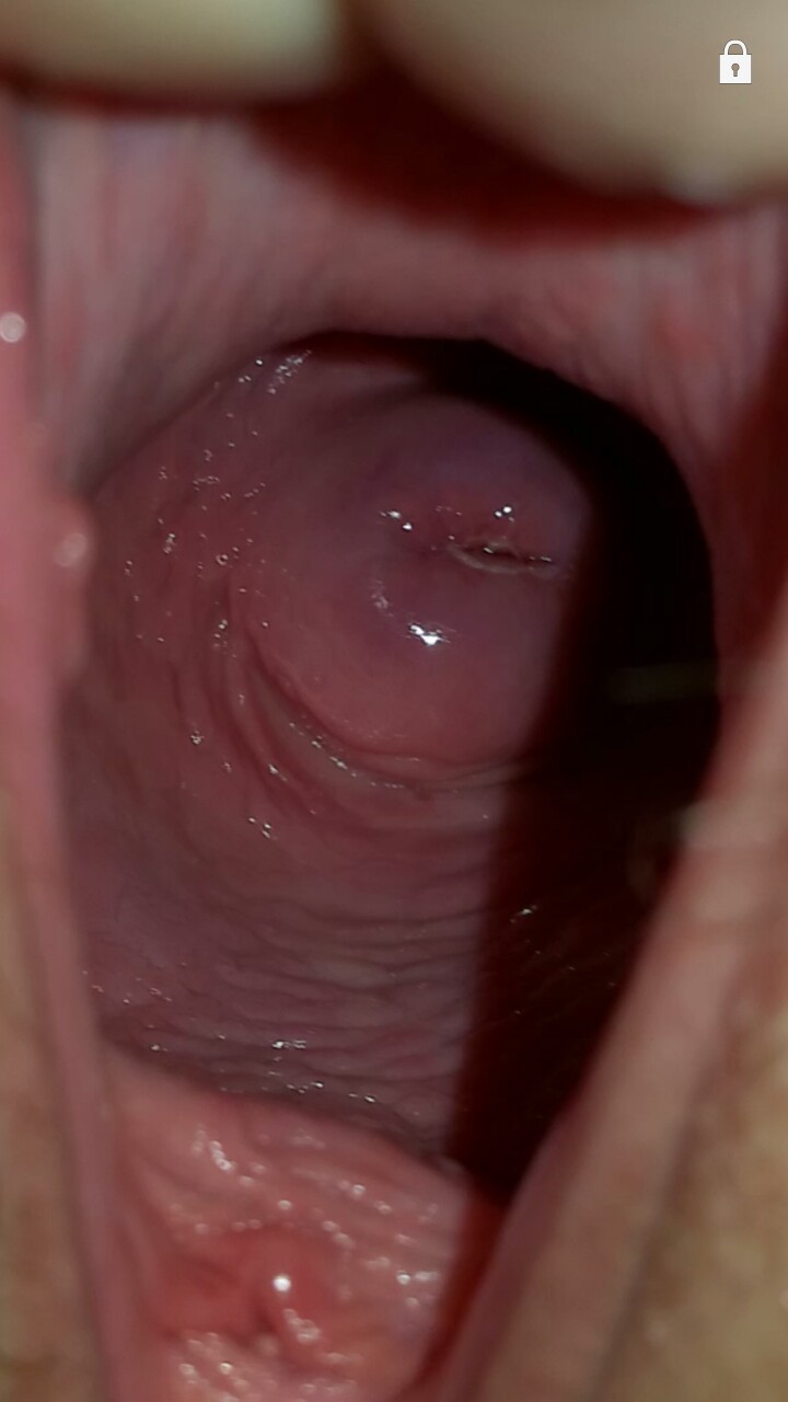 View Inside A Pussy 8