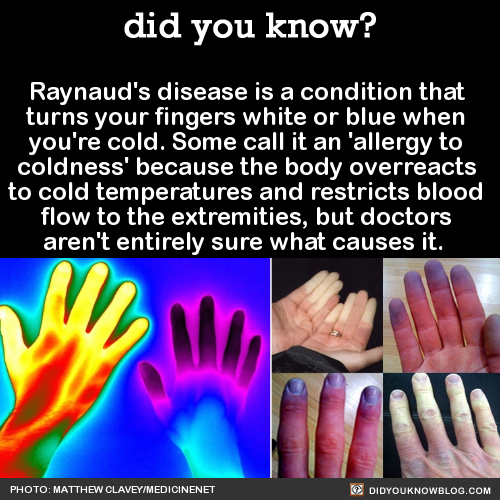 raynauds-disease-is-a-condition-that-turns-your