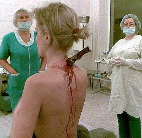 odditiesunsolved:
“An extraordinary picture that has gone around the world of a knife plunged into the back of a woman mugging victim is genuine, it was revealed by doctors in Moscow.
Julia Popova, 22, was stabbed by a mugger as she walked home from...